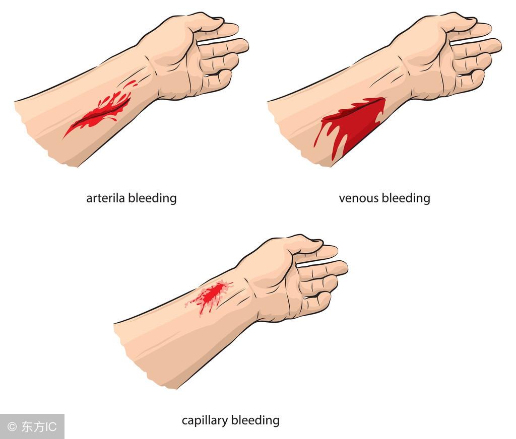 落地生根什么時(shí)候開(kāi)花，落地生根怎么治痔瘡?